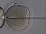 IVF